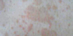 ëѡ񲻵ʧ ²֢ݱƤ